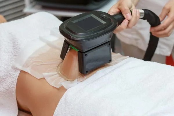 Image of person having fat freezing treatment to help weight gain Eccles