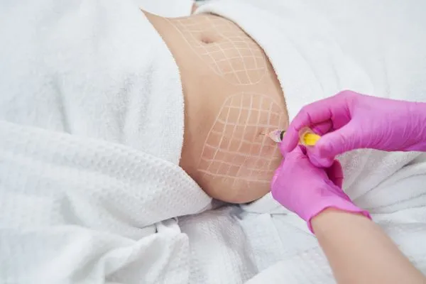 image of fat dissolving injections on love handles to help combat weight gain Eccles