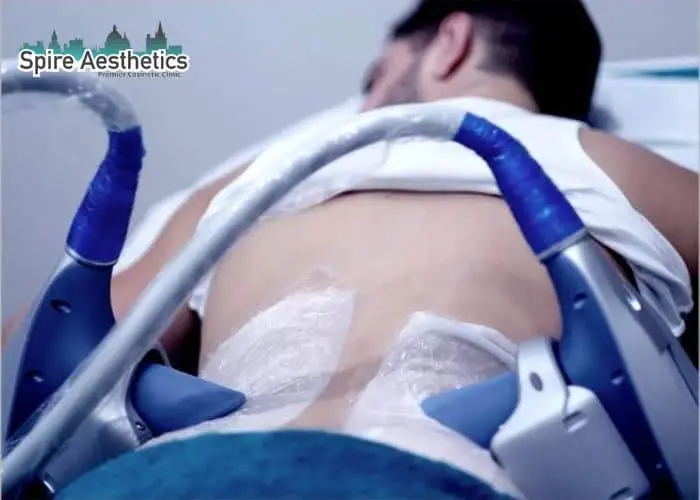Man having fat freezing treatment done on love handles before a competitions Eccles to create a sculpted look.