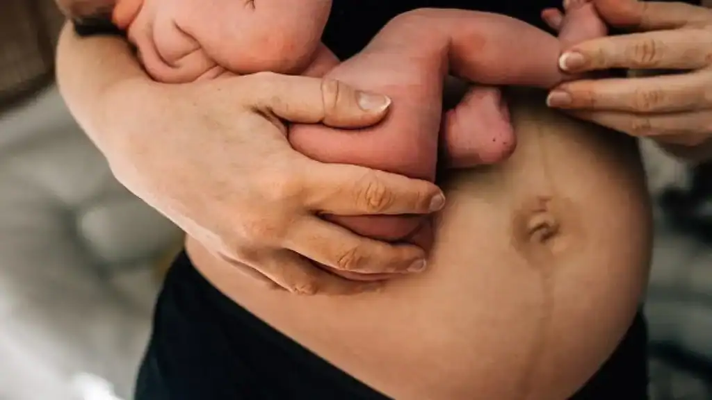Why Is My Stomach Still Big After Pregnancy Eccles?